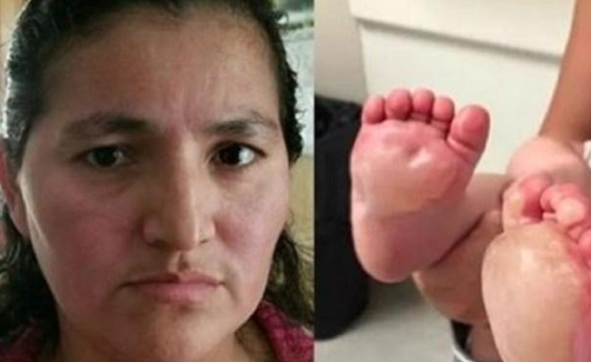 Une maman trouve des cloques sur les pieds de sa fille: Elle alerte tous les parents pour ne pas que l'histoire se rpte ! 